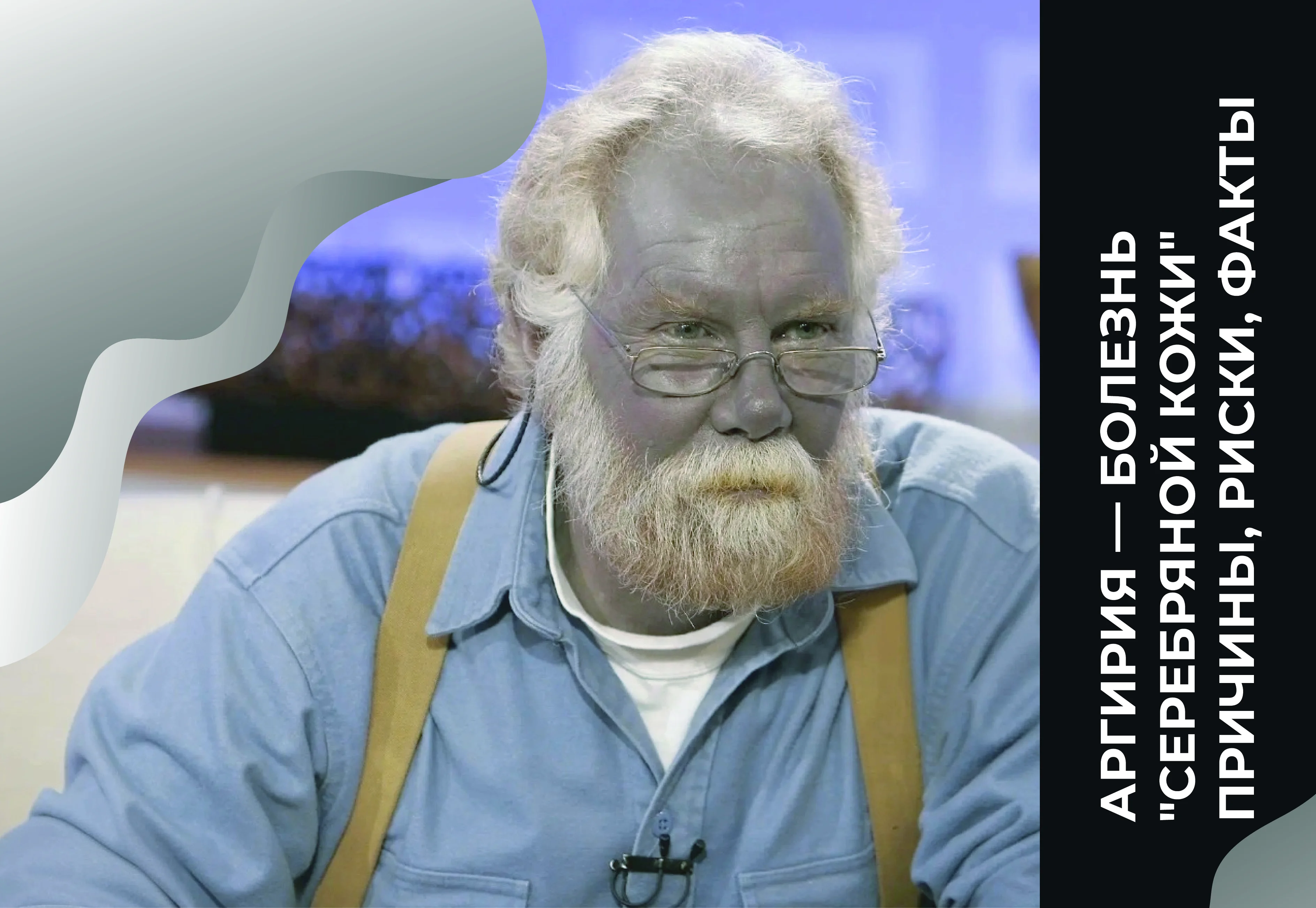 Аргирия — болезнь 